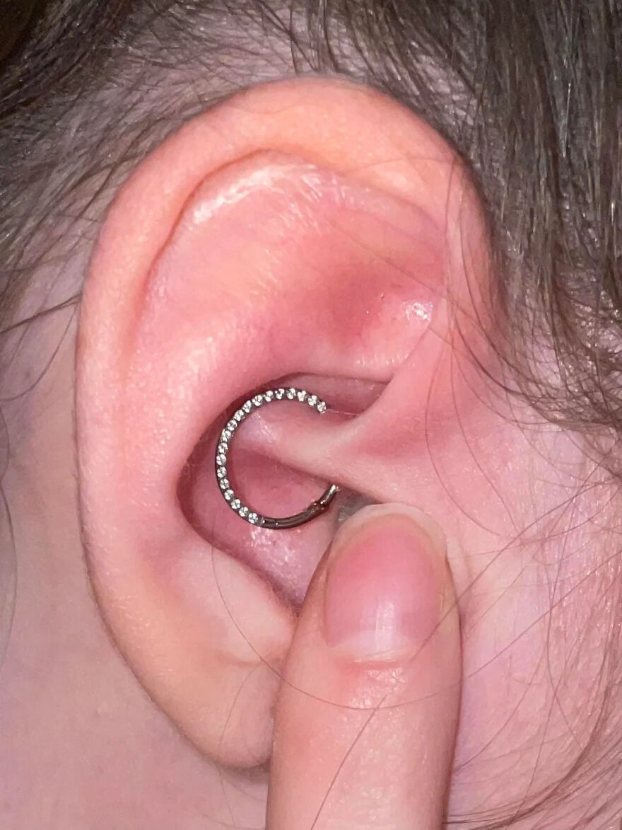 Close-up of an ear with a daith piercing featuring a jeweled hoop, illustrating a type of ear piercing.