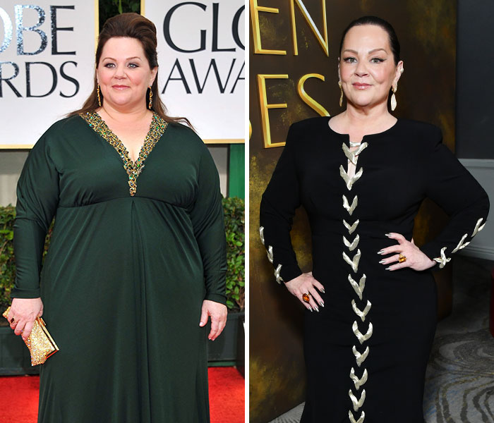 Actress showcasing dramatic transformations at the 2026 Golden Globes, highlighting stunning star style evolutions.