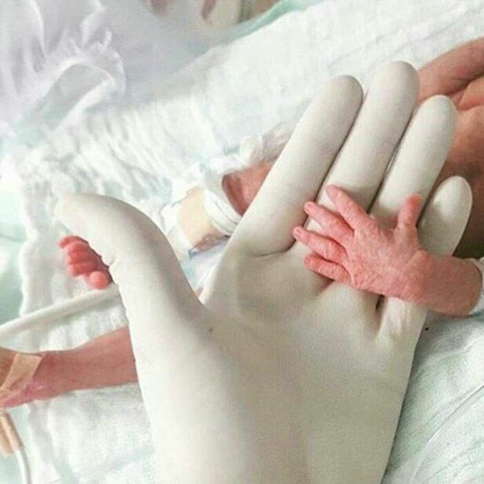 Mano médica con guante sosteniendo la mano diminuta y delicada de un recién nacido en una imagen médica impactante.