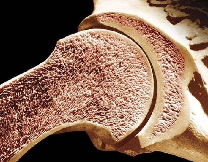 Close-up of a cross-section of human bone structure showing detailed porous texture in a medical pic.