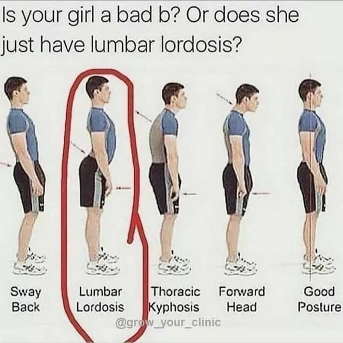 Humorous meme illustrating different posture types including lumbar lordosis, with dark humor and a touch of darkness.
