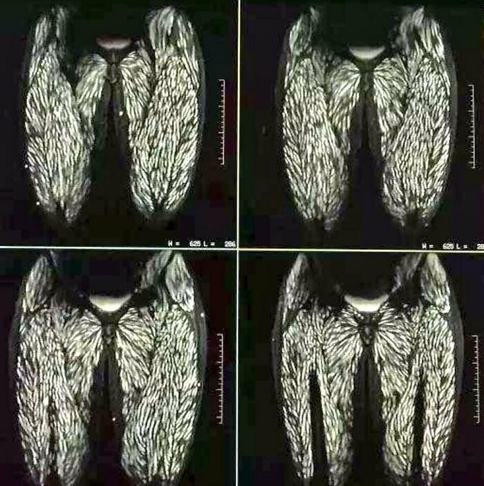 Imágenes médicas hipnóticas y extrañas mostrando detalle de músculos y fibras en escaneo médico avanzado.