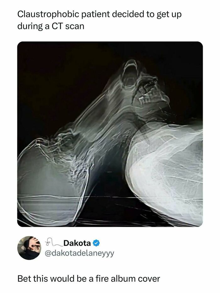 X-ray scan showing a patient's movement during a CT scan, featured in entertaining posts and memes to fight boredom.