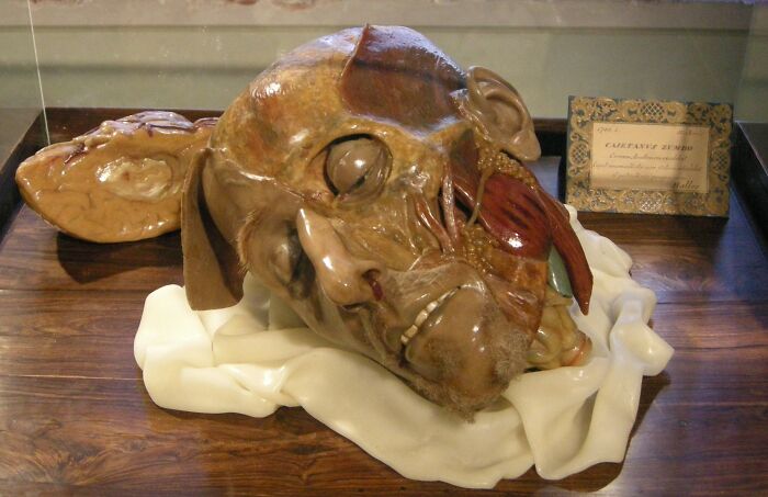 46 Obscure And Weird Medical Facts