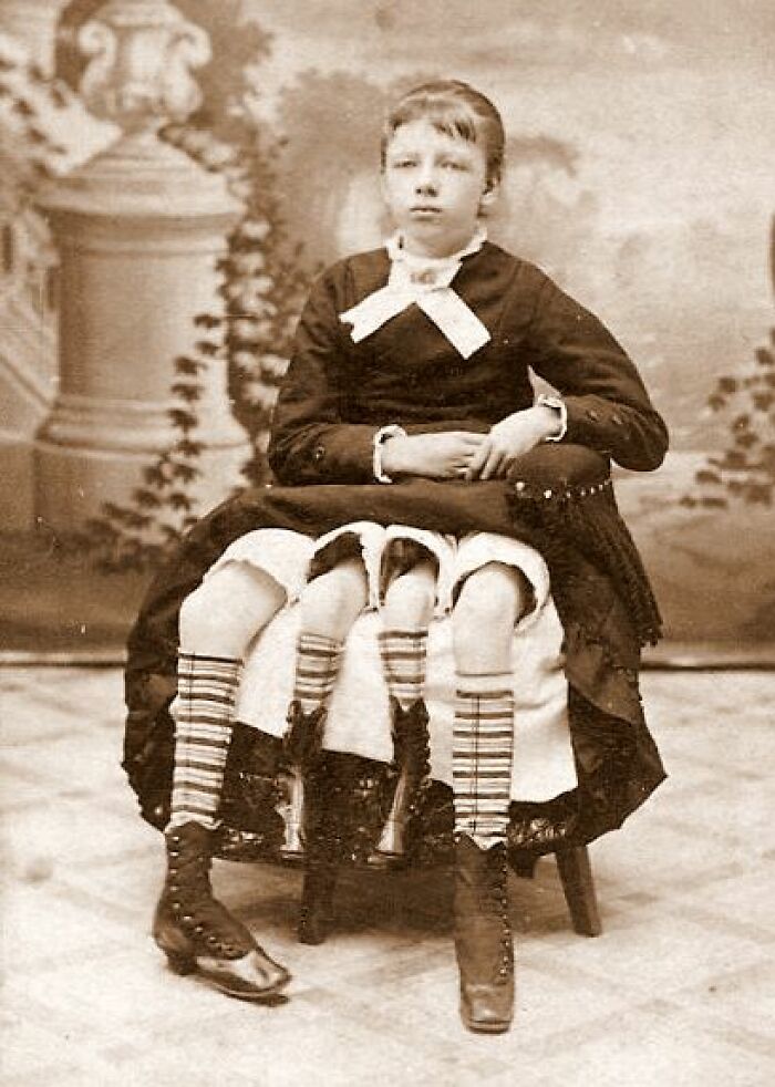 Old black and white creepy photo of a woman with three legs wearing striped stockings and vintage boots.