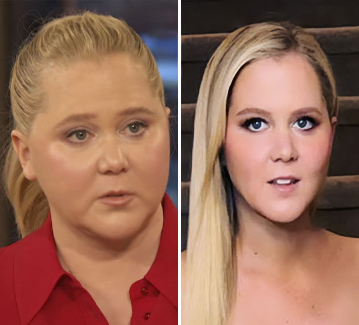 Amy Schumer's Bikini Shots Stun After Major Weight Loss Transformation Amy Schumer's Bikini Shots Stun After Major Weight Loss Transformation