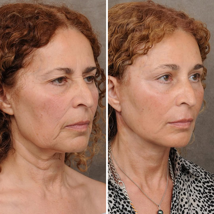 Plastic Surgeon Goes Viral After Dry Response To Facelift Critic Leaves Internet Laughing Hard