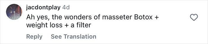 Instagram comment saying wonders of masseter Botox, weight loss, and a filter in black text on a white background.