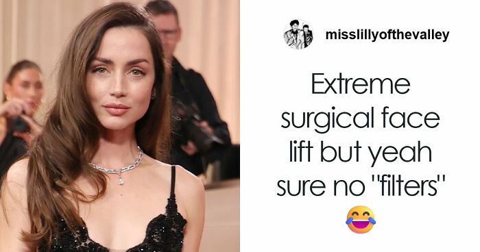 “This Is Not Filler, This Is Not Botox”: Celeb Facialist Reveals Secrets Behind Golden Globes Glow