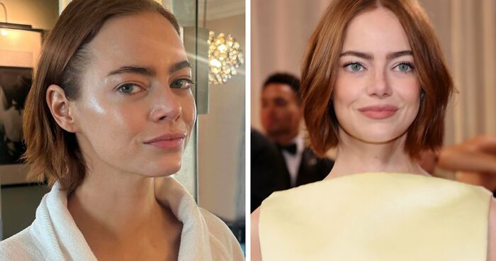 “This Is Not Filler, This Is Not Botox”: Celeb Facialist Reveals Secrets Behind Golden Globes Glow