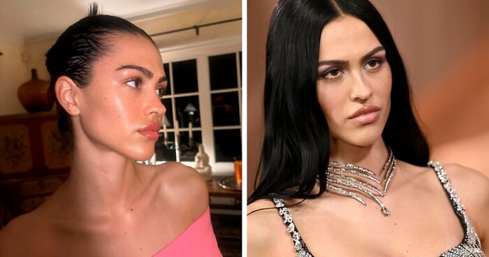 “This Is Not Filler, This Is Not Botox”: Celeb Facialist Reveals Secrets Behind Golden Globes Glow