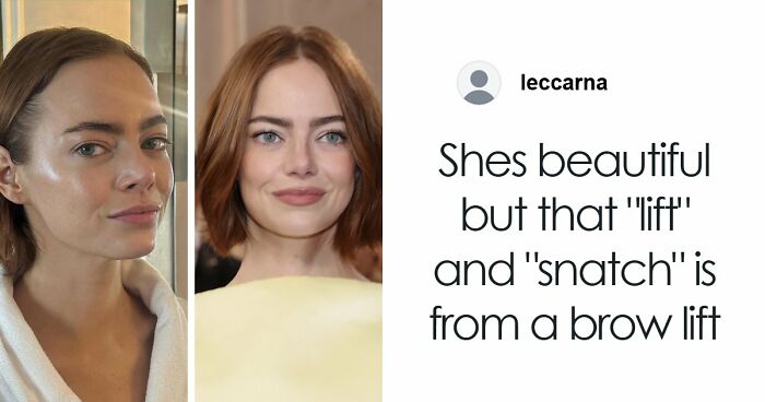 “This Is Not Filler, This Is Not Botox”: Celeb Facialist Reveals Secrets Behind Golden Globes Glow