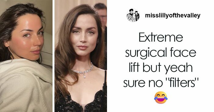 “Like A Plastic Robot”: Facialist Reveals What Celebrities Actually Did Before The Golden Globes