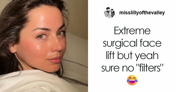 “This Is Not Filler, This Is Not Botox”: Celeb Facialist Reveals Secrets Behind Golden Globes Glow