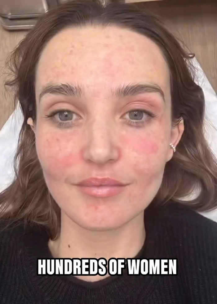 “Really Disturbing”: SNL Star Reveals “Botched” Cosmetic Procedures In Concerning Photos “Really Disturbing”: SNL Star Reveals “Botched” Cosmetic Procedures In Concerning Photos