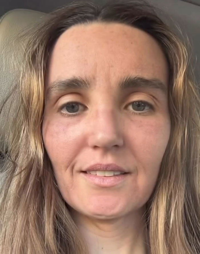 “Really Disturbing”: SNL Star Reveals “Botched” Cosmetic Procedures In Concerning Photos “Really Disturbing”: SNL Star Reveals “Botched” Cosmetic Procedures In Concerning Photos