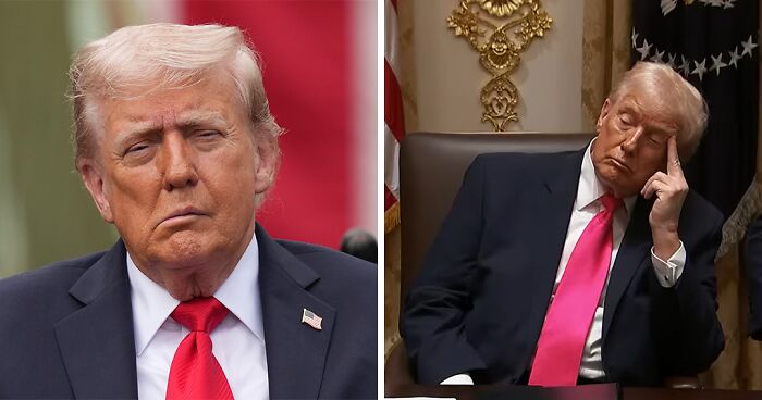 “That’s Why His Face Is Droopy”: Trump Tries To Shut Down Health Speculation As Doctor Raises Concerns