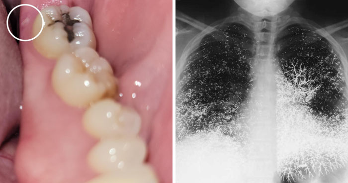 30 Casos médicos fascinantes cuyas imágenes no puede soportar cualquiera