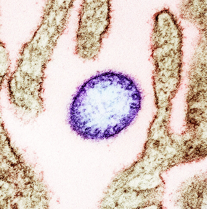 Microscopic image of an incurable virus causing COVID-style restrictions and warnings issued by doctors at airports.