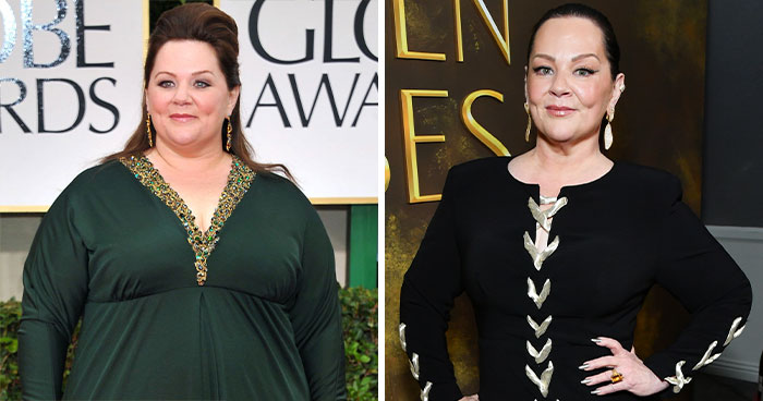“She Needs Help”: Fan Frenzy Over Botched Plastic Surgery And Weight Loss After The Golden Globes