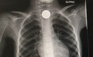 75 Expensive Mistakes People Made That Might Make You Say “Ouch” Just Looking At Them (New Pics)