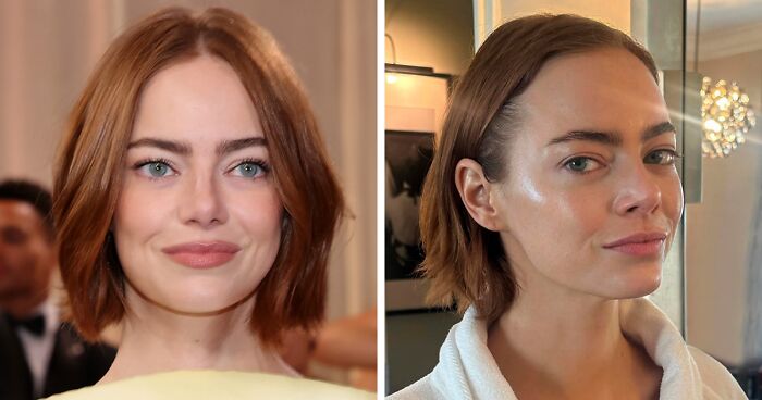 “This Is Not Filler, This Is Not Botox”: Celeb Facialist Reveals Secrets Behind Golden Globes Glow