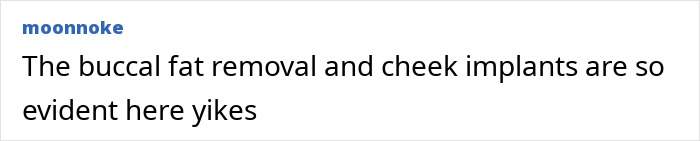 Comment stating buccal fat removal and cheek implants are evident, referencing fans blaming plastic surgery on Selena Gomez's transformation.