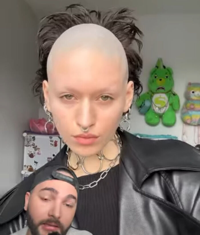 Persona con peinado ridículo y calvo en la parte superior, mostrando un estilo de cabello inesperado y llamativo.