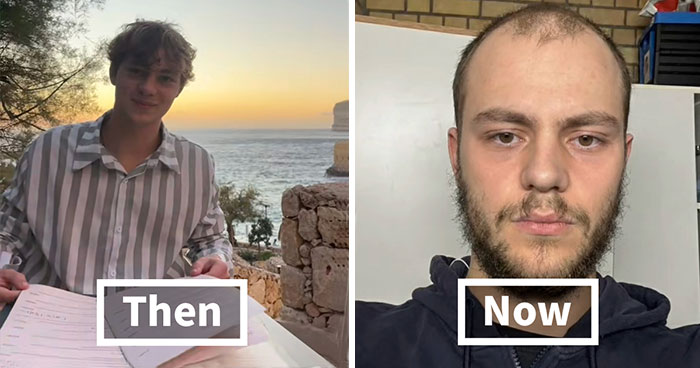 67 People Get Vulnerable By Sharing How They’ve Glowed Down Since They ‘Peaked’