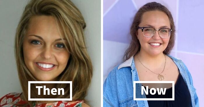 67 People Who Went Through It Shared How It Affected Their Looks Compared To Their Peak
