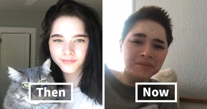 67 People Get Vulnerable By Sharing How They’ve Glowed Down Since They ‘Peaked’