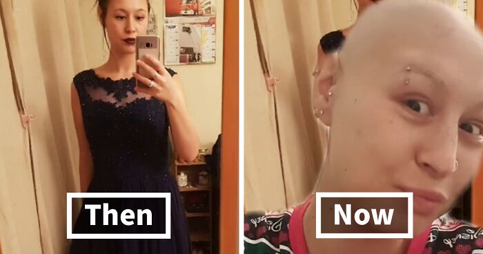 67 People Get Vulnerable By Sharing How They’ve Glowed Down Since They ‘Peaked’