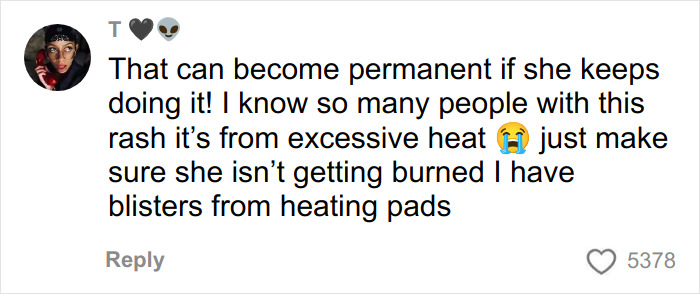 Social media comment warning about rashes and blisters caused by excessive heating pad use and toasted skin syndrome.