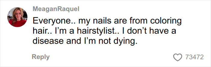 Comment from user MeaganRaquel clarifying nails are from hair coloring, not a disease, related to toasted skin syndrome awareness.