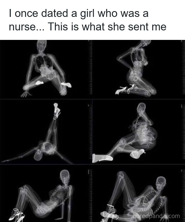 X-ray images of a skeleton in various poses sent by a nurse, showcasing dark humor memes for fans of edgy comedy.