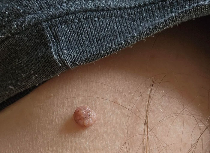 57 Things Women Did To Their Bodies As Teens Because Beauty Standards Said They Should