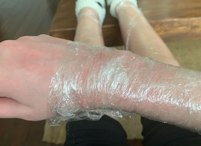 57 Things Women Did To Their Bodies As Teens Because Beauty Standards Said They Should