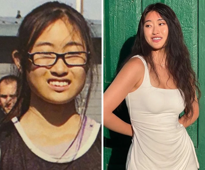 Side-by-side dramatic before and after pics of a young woman showing a stunning transformation without glasses.