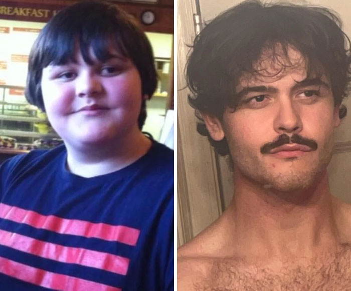 Before and after dramatic transformation of a young man showing significant weight loss and facial changes in two side-by-side photos.