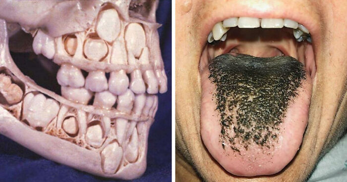 80 Fascinating And Unnerving Medical Pics You May Need A Moment To Process