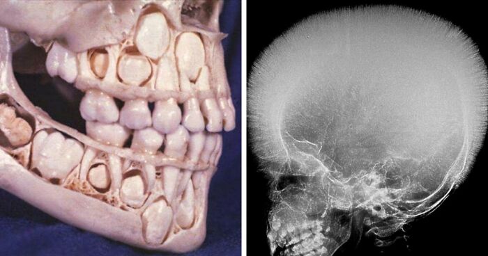80 Fascinating And Unnerving Medical Pics You May Need A Moment To Process