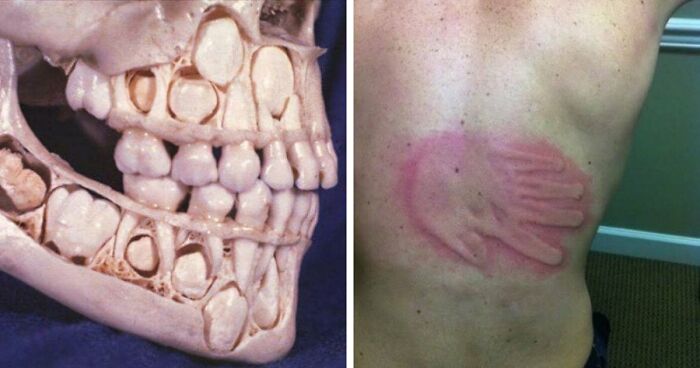 80 Medical Pics That Are Weirdly Mesmerizing And Slightly Disturbing