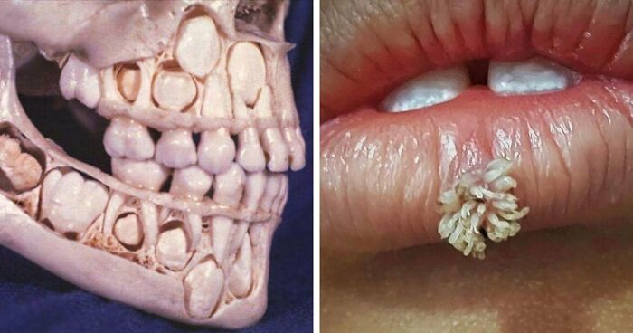 80 Medical Pics That Are Weirdly Mesmerizing And Slightly Disturbing