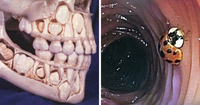 80 Medical Pics That Are Weirdly Mesmerizing And Slightly Disturbing