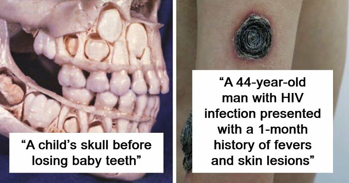 80 Fascinating And Unnerving Medical Photos Not Everyone Can Handle