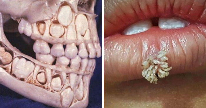 50 Medical Pics That Are Weirdly Mesmerizing And Slightly Disturbing