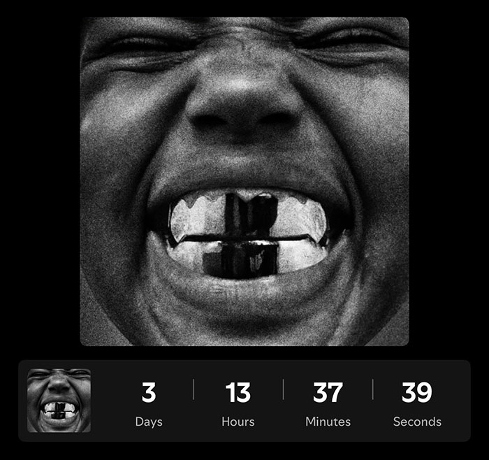 Close-up black and white image of a person showing metallic vampire fangs, related to Kanye West health battle reveal.