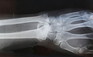 “The Marriage Lasted Two Months”: 62 Times Wedding Guests Realized The Couple Was Basically Doomed