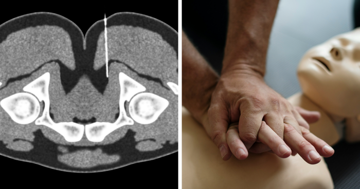 62 Weird Medical Facts That Turned Out To Be True