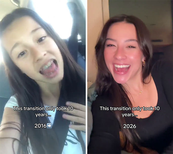 Side-by-side photos showing a young woman’s 2016 vs 2026 transformation shared by 65 people over 10 years